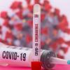 COVID-19 vaccin